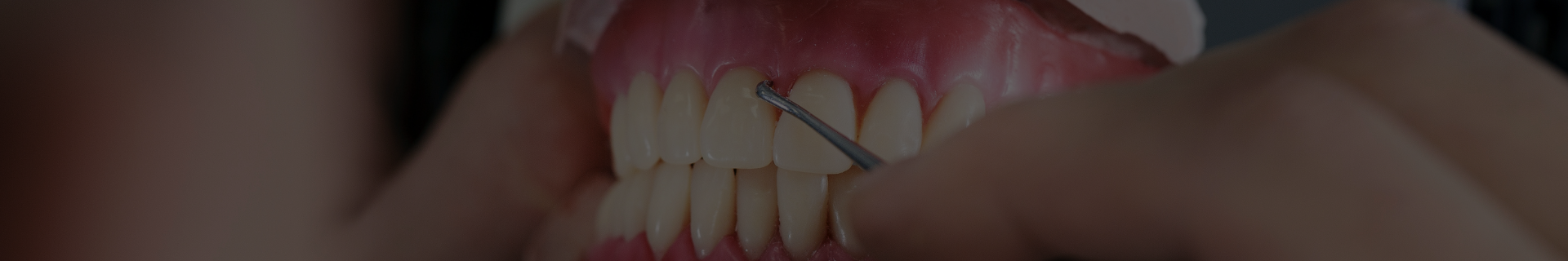 profilaxie dentara detartraj Buzau, igienizare