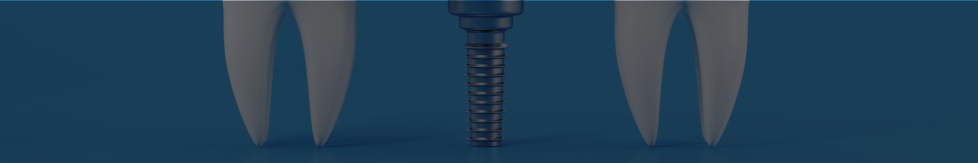 implant dentar Bucuresti Aviatiei si Buzau