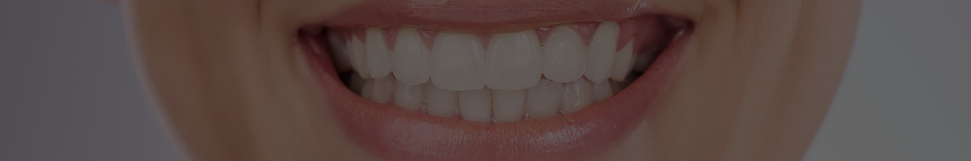albire dinți București albire dentară Buzău