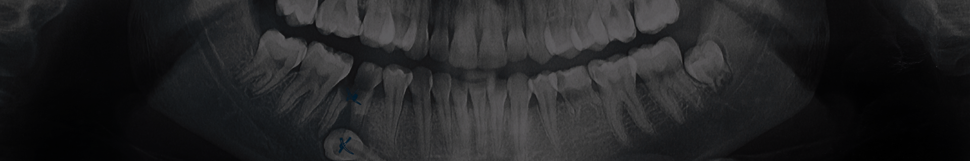 Bucuresti radiolografie dentara Buzau dentist