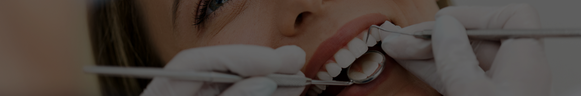 igienizare dentara Bucuresti Aviatiei, sector 1